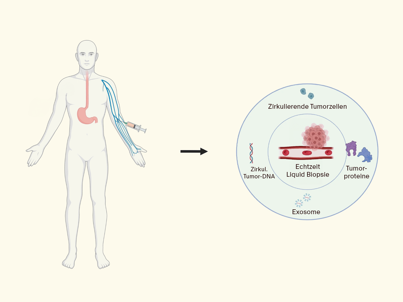 LiquidBiopsie_1.png