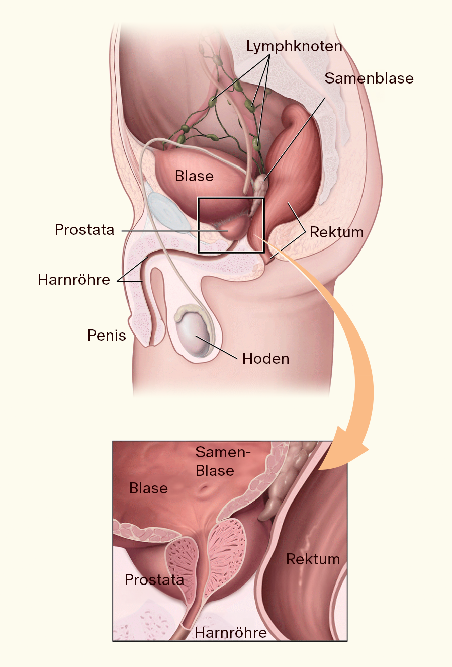 Prostatakrebs: Ursachen, Vorsorge und Früherkennung – Ein umfassender Leitfaden