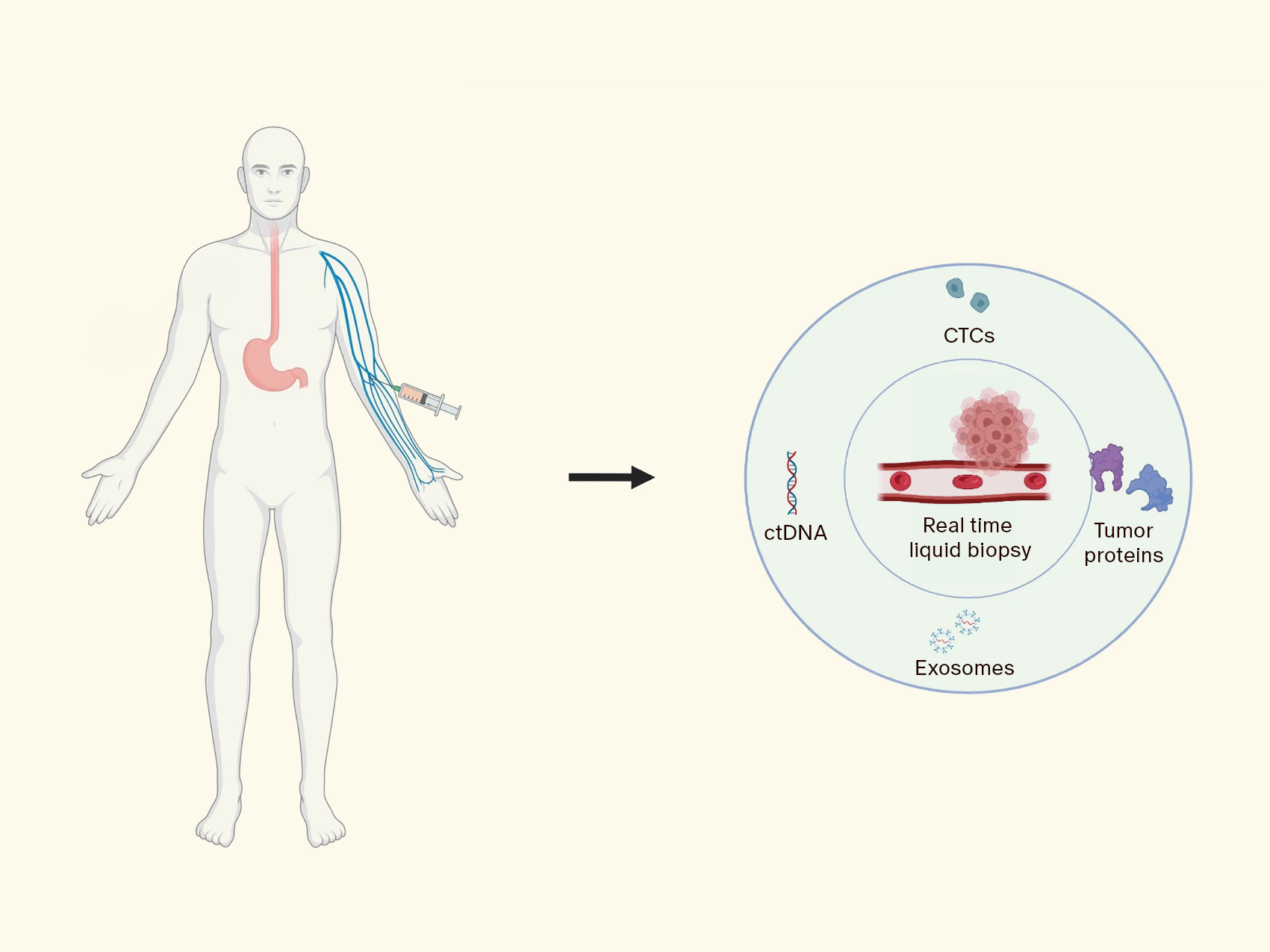 Liquid Biopsy 101: The Future of Cancer Detection