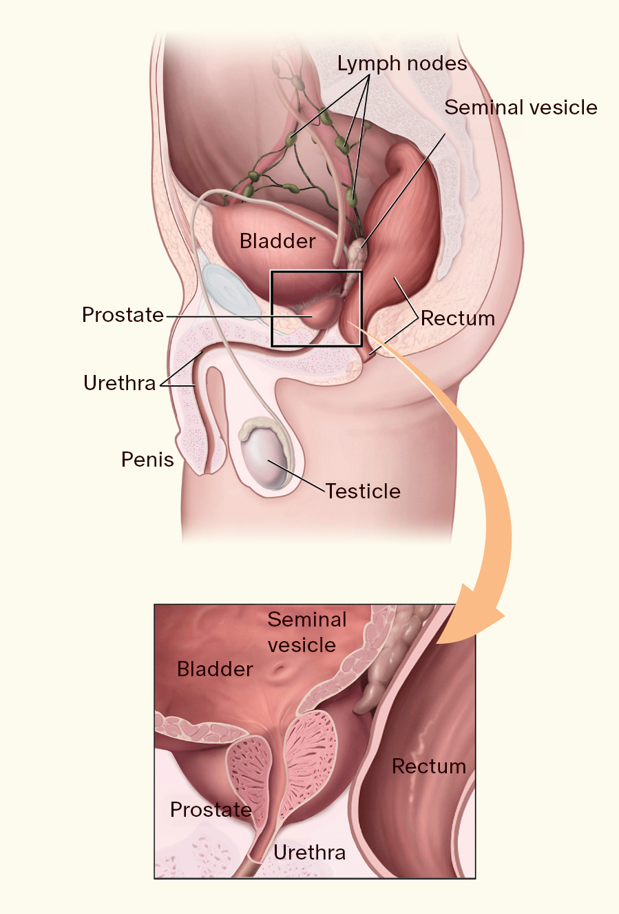 Prostate Cancer – How to Prevent and Treat It?