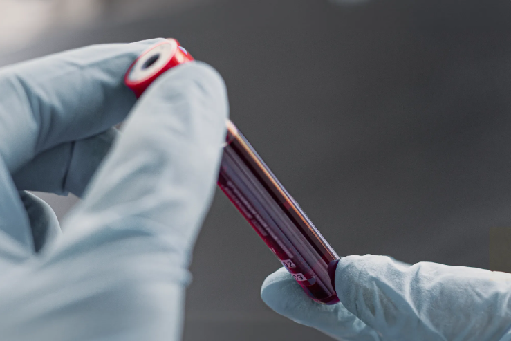 How Reliable Are Blood Tests for Cancer Screening?